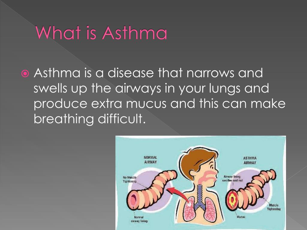 asthma definition