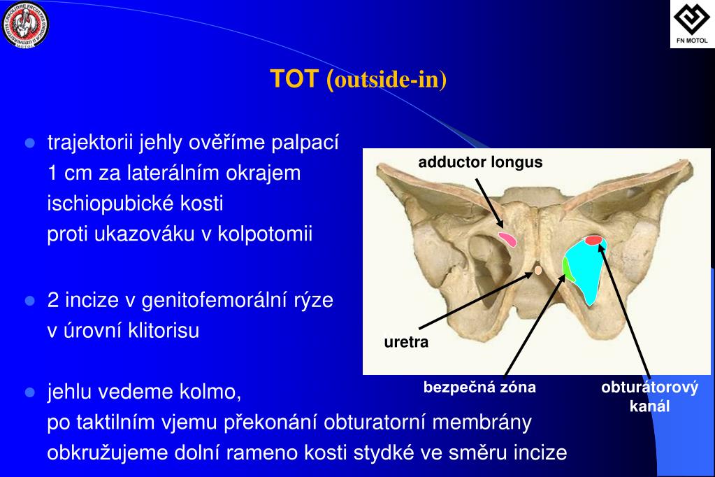 PPT - vývoj moderních materiálů + objasnění patofyziologie PowerPoint  Presentation - ID:2258083