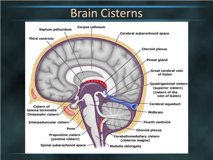 PPT - Brain Cisterns PowerPoint Presentation - ID:2263744
