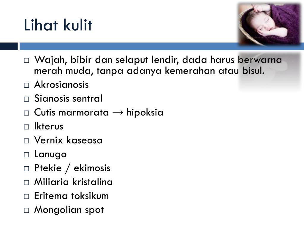 PPT Pemeriksaan Fisik Bayi PowerPoint Presentation, free