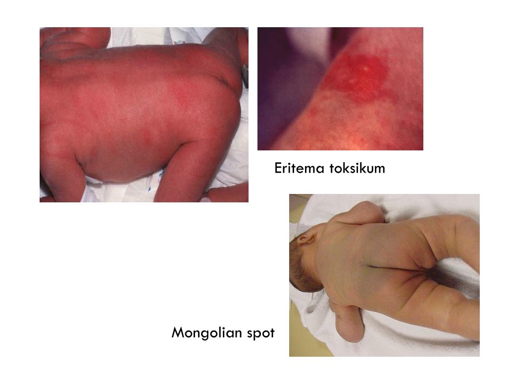 PPT Pemeriksaan Fisik Bayi PowerPoint Presentation, free