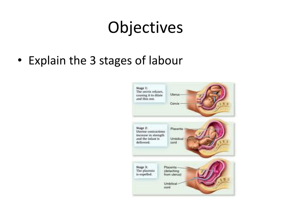 presentation in labour