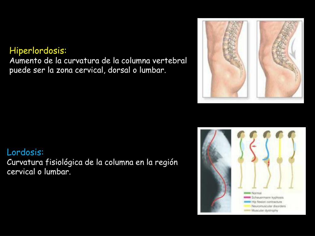 PPT UNIVERSIDAD TECNICA DE MANABI EXPOSICION DE ANATOMIA COLUMNA