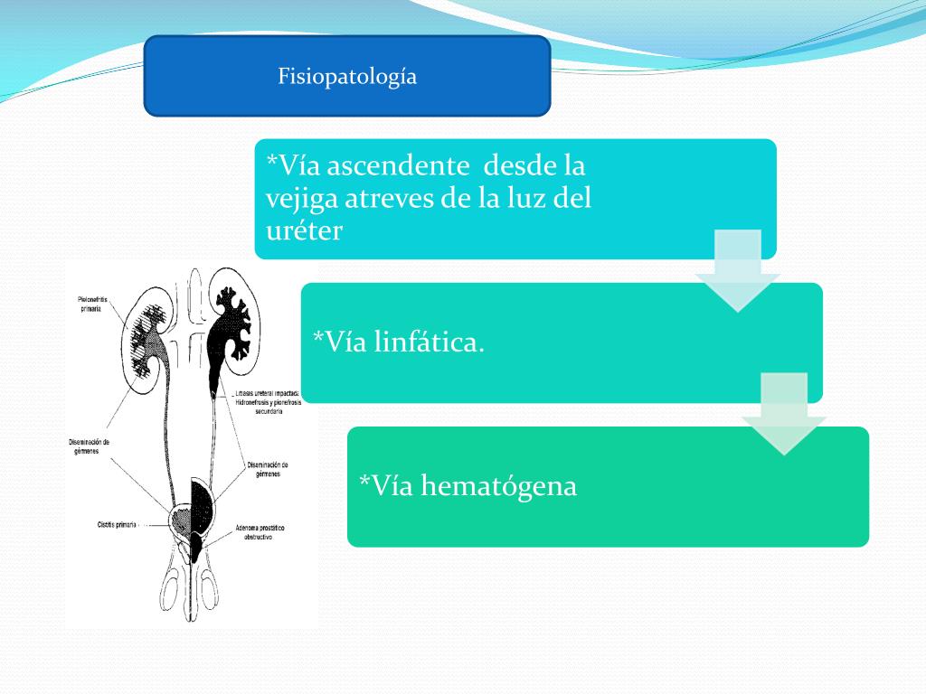 PPT - INFECCIONES DE VIAS URINARIAS AGUDAS Y CRONICAS PowerPoint