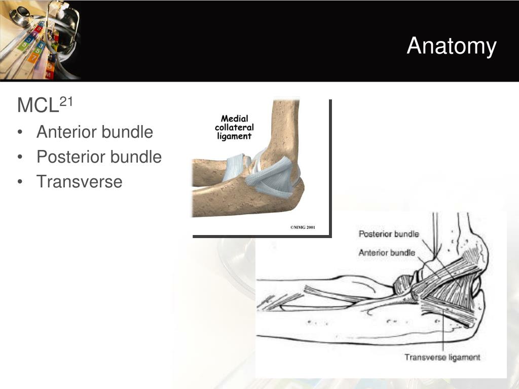 PPT - Lateral Elbow Instability PowerPoint Presentation, free download ...