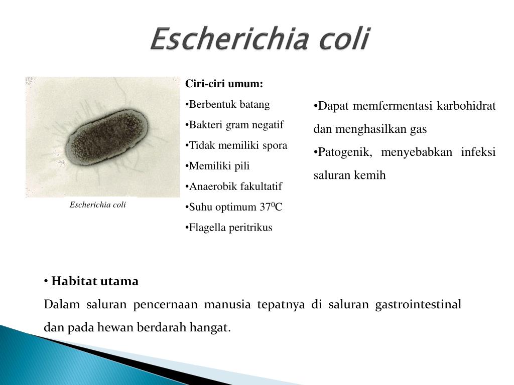 Escherichia coli что это у мужчин. Морфология эшерихии коли. Возбудитель эшерихии коли. Escherichia coli эшерихии. Escherichia coli антибиотики.