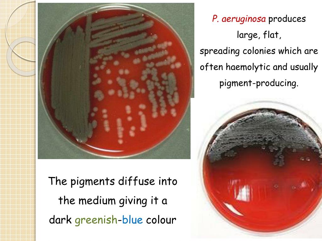 pseudomonas aeruginosa on macconkey agar