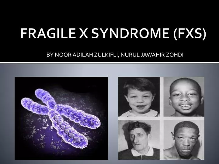 fragile x syndrome t shirts