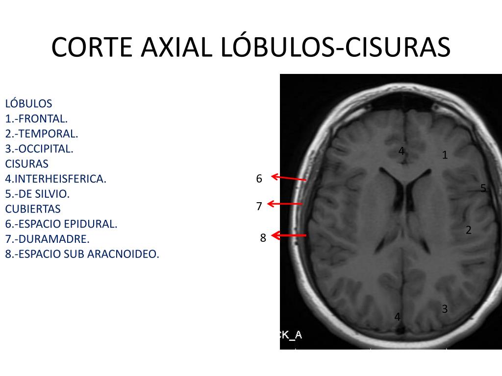 ppt-anat-mia-sn-patolog-a-i-sistema-nervioso-central-powerpoint