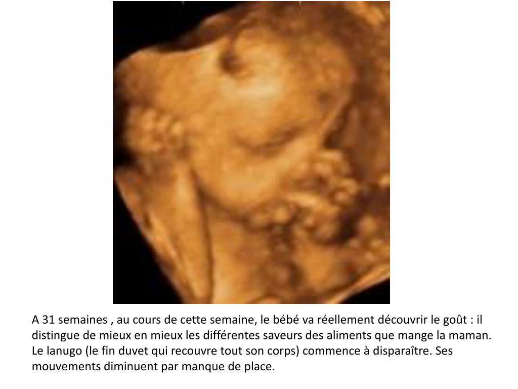 Ppt A 18 Semaines Dans Le Systeme Respiratoire L Arbre Bronchique Est Maintenant Presque Termine Powerpoint Presentation Id