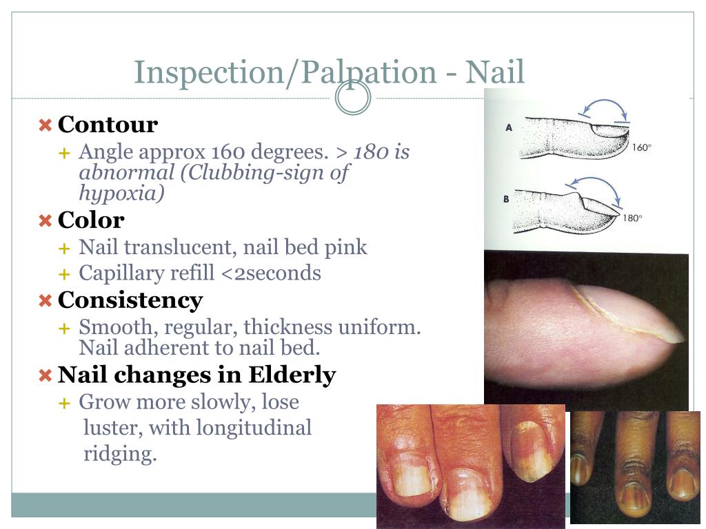 PPT NRS 103 Skin, Hair, and Nails Chapter 9 PowerPoint Presentation