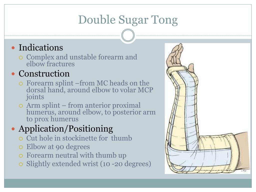 PPT Procedures Splinting PowerPoint Presentation, free download ID