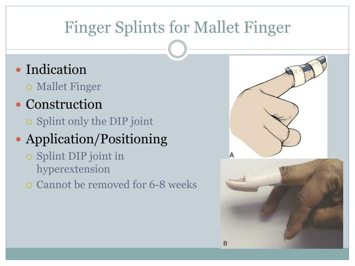 PPT Procedures Splinting PowerPoint Presentation ID2280962