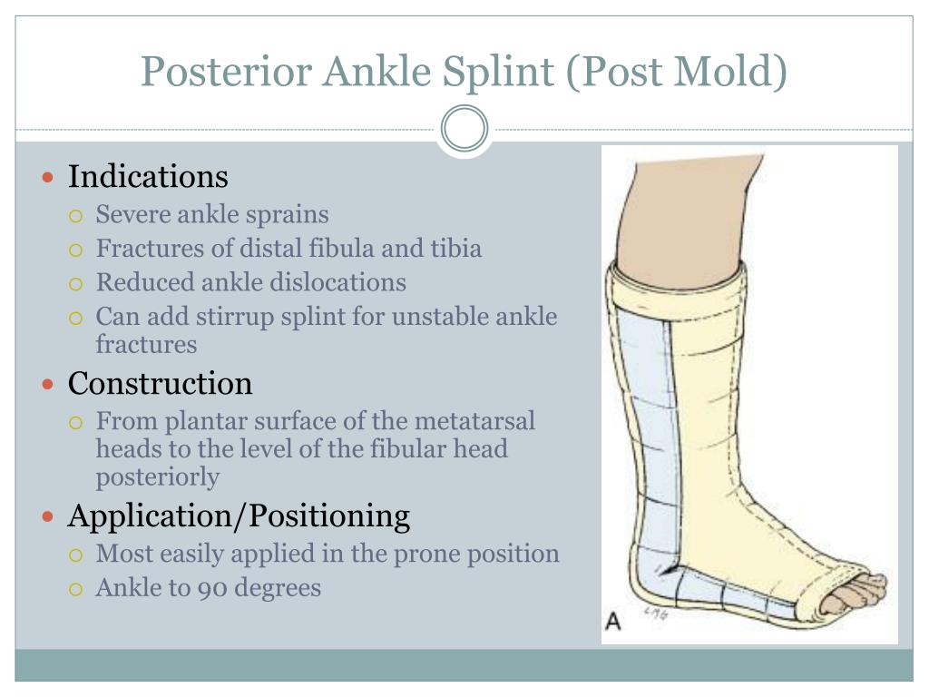 PPT Procedures Splinting PowerPoint Presentation Free Download ID 