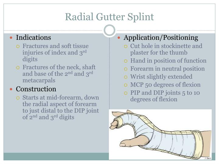 PPT Procedures Splinting PowerPoint Presentation ID2280962