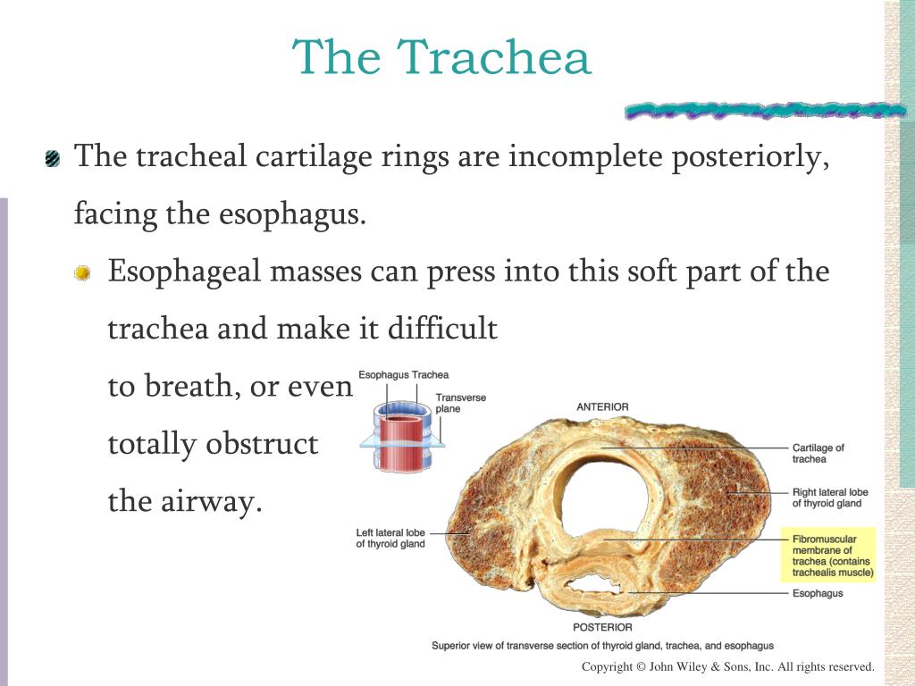 Trachea and Larynx - Physiopedia