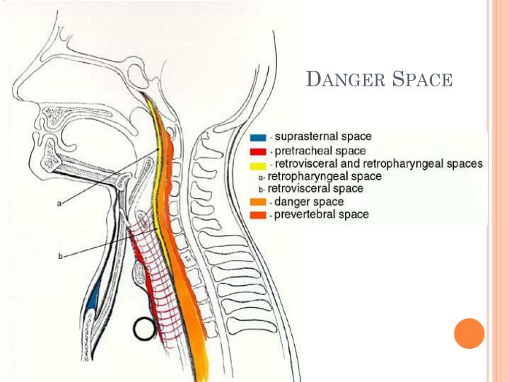PPT Anatomy of Head and Neck Infections PowerPoint Presentation ID