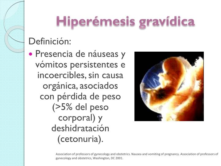 PPT - Hiperémesis Gravídica PowerPoint Presentation - ID:2282692