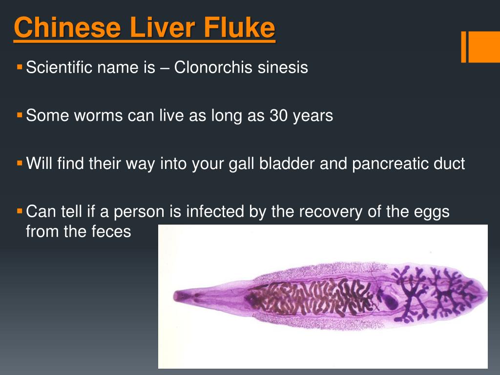 PPT Parasites Giant Intestinal Fluke Chinese Liver Fluke Sheep