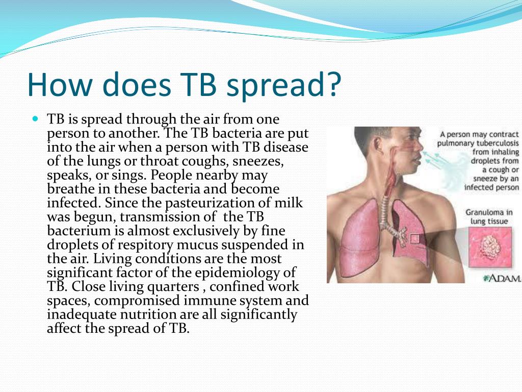 PPT - Tuberculosis (TB) PowerPoint Presentation, free download - ID:2286711