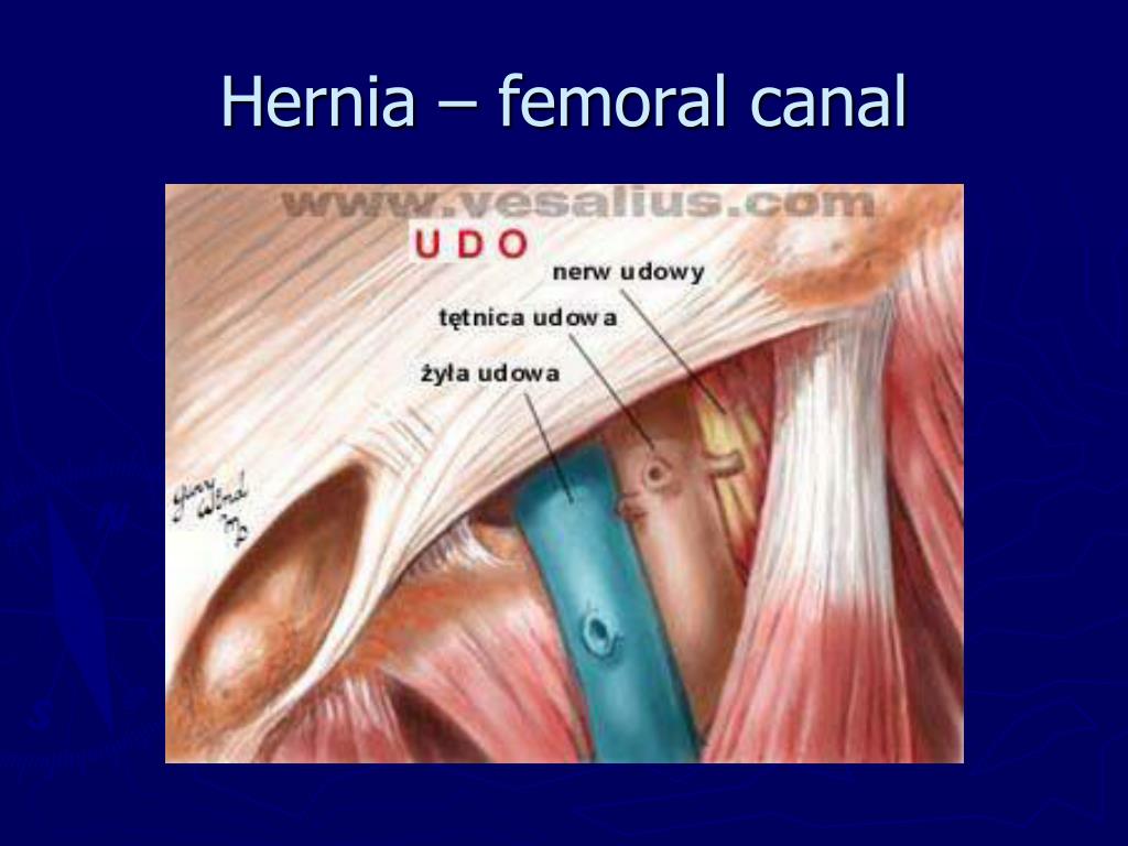Femoral Canal