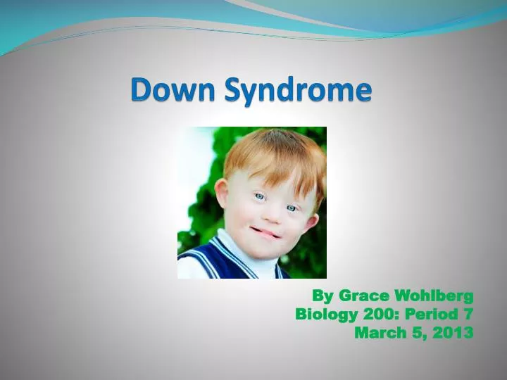 PPT Down Syndrome PowerPoint Presentation free download ID:2307614