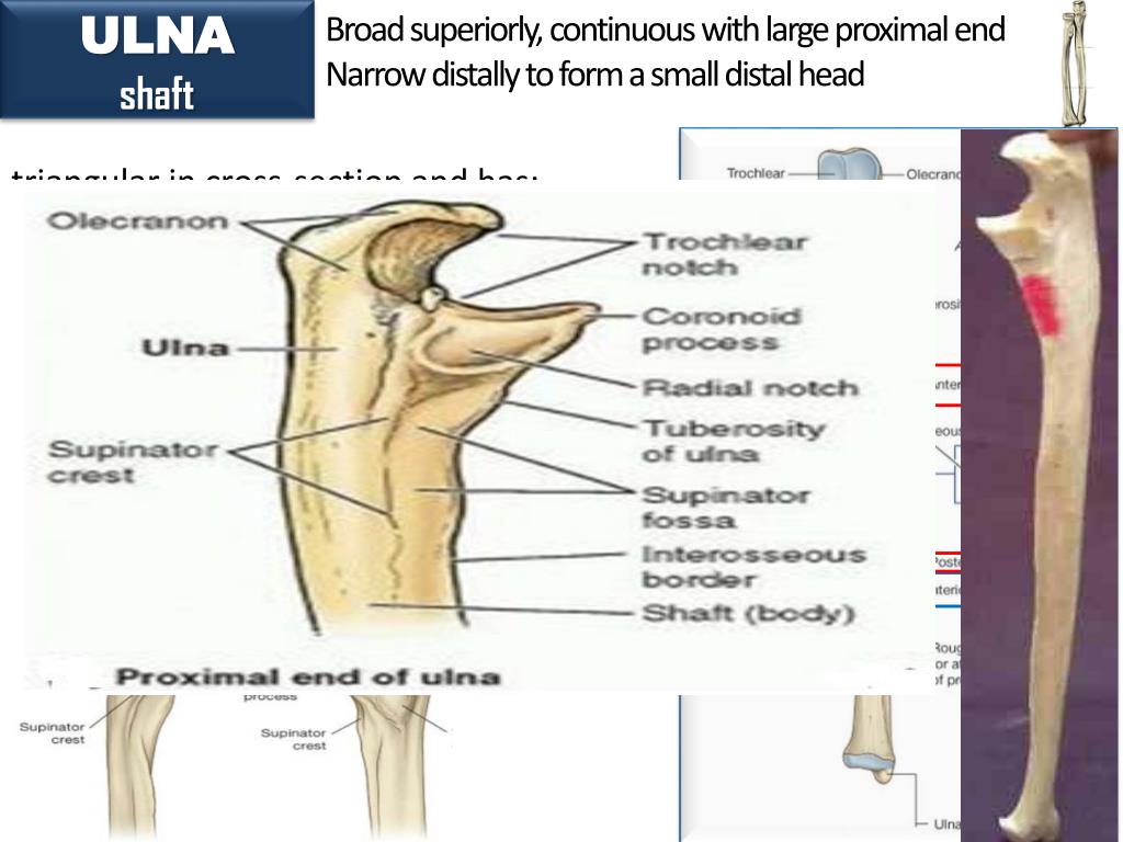 PPT - BONES OF THE UPPER LIMB PowerPoint Presentation, free download