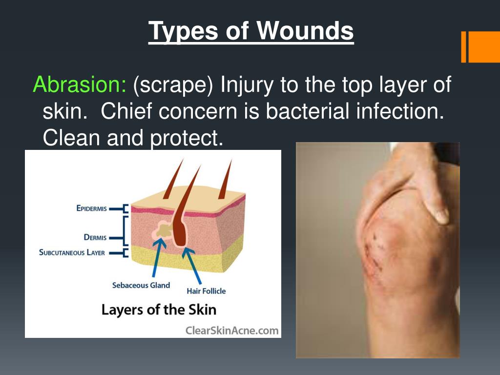 PPT First Aid PowerPoint Presentation, free download ID2313111