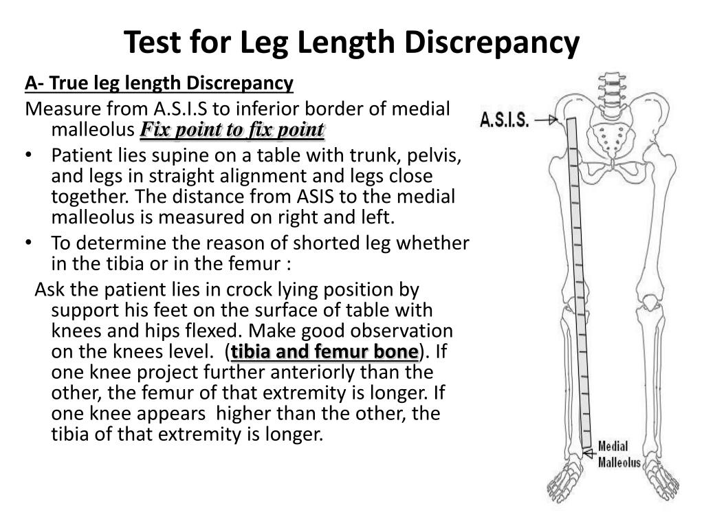 true leg length discrepancy test