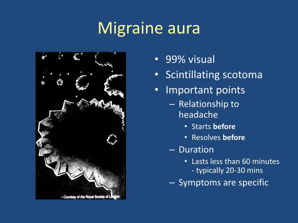 Aura Migraine Ophtalmique Migraine Avec Aura D finition CASZ Aura Migraine Ophtalmique Migraine Avec Aura D finition CASZ