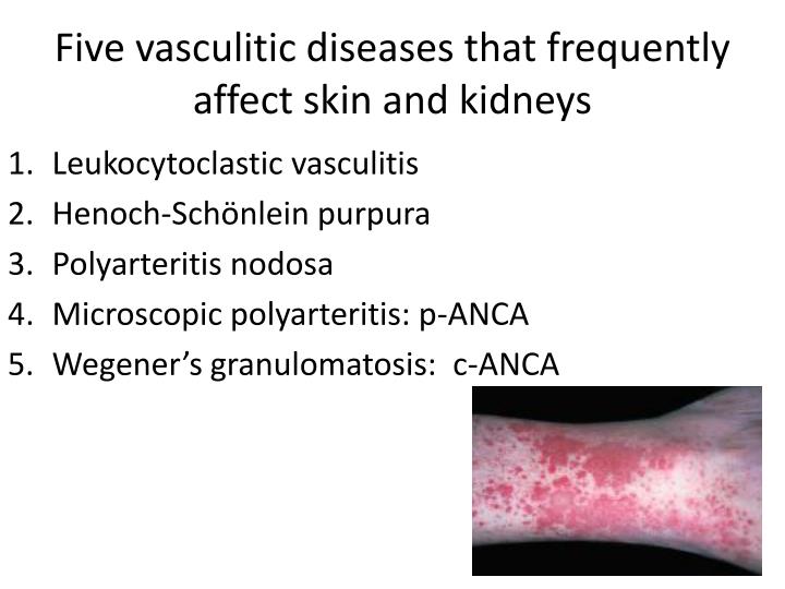 PPT - Cutaneous Manifestations of Renal Disease PowerPoint Presentation ...