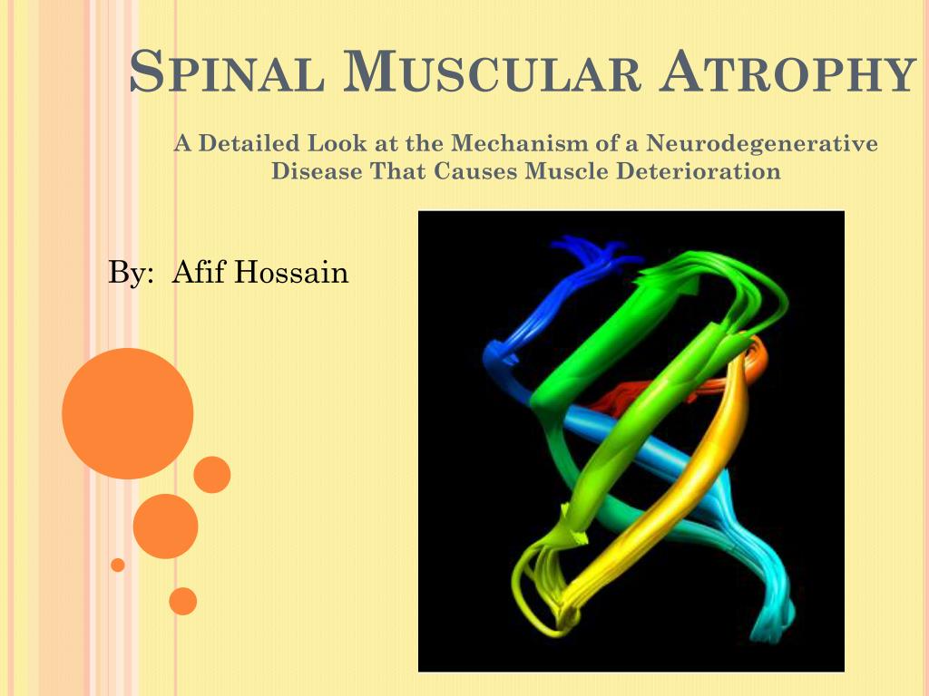 Spinal Muscular Atrophy A Detailed Look at the Mechanism of a Neurodegenera...