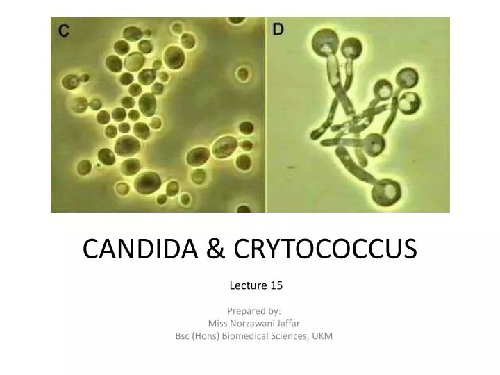candida crytococcus n.