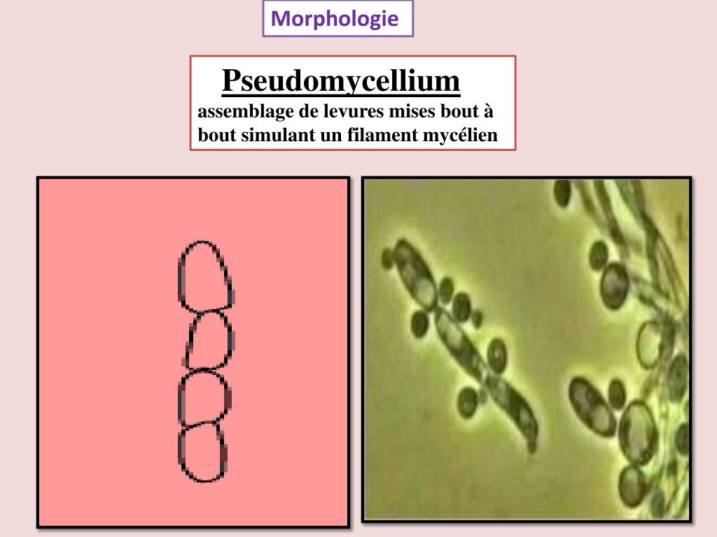 Difference Entre Candida Albicans Et Monilia Albicans PPT - Candidoses PowerPoint Presentation, free download - ID:2326734