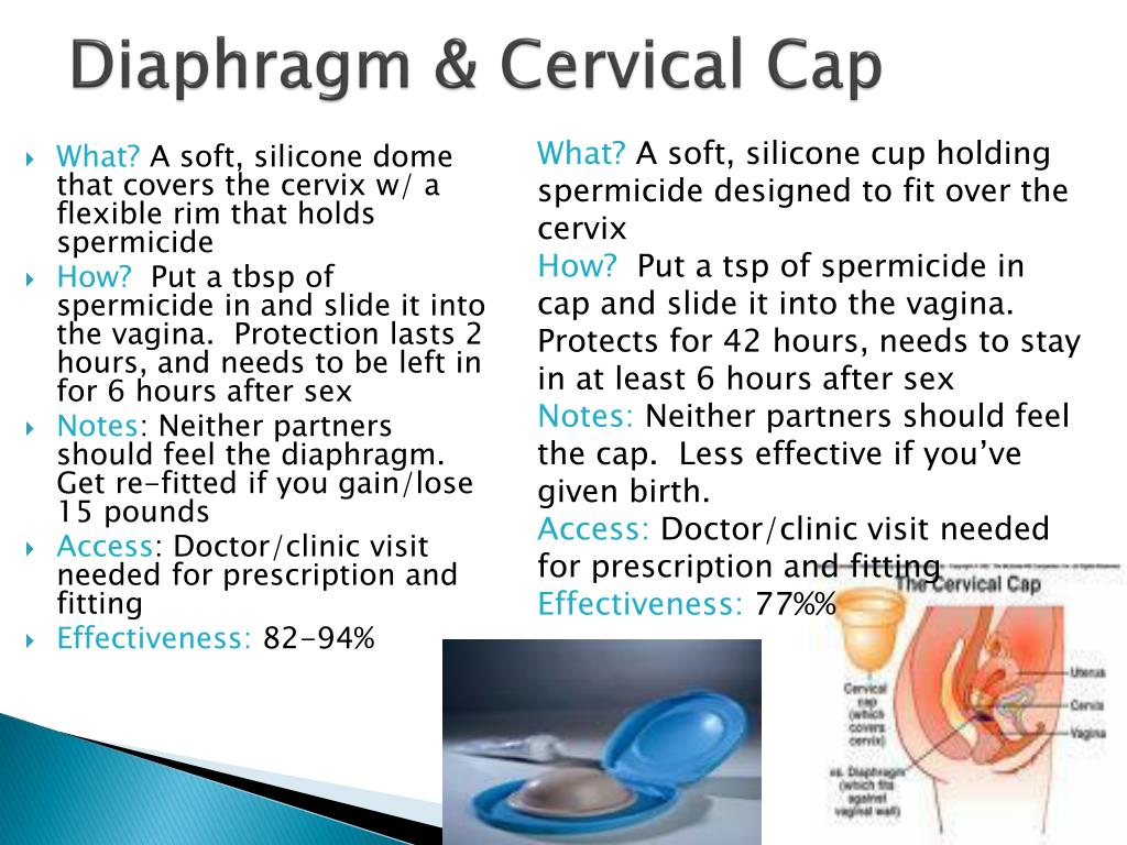 Ppt contraception powerpoint presentation free download id 2327722