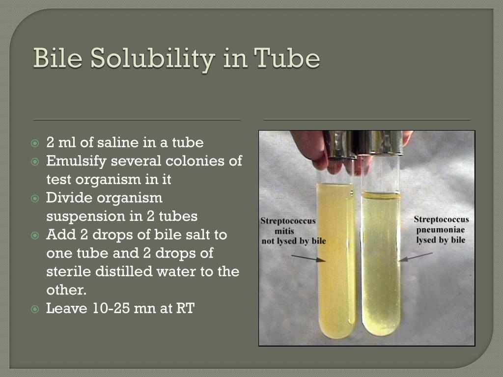 bile-solubility-in-tube-l.jpg