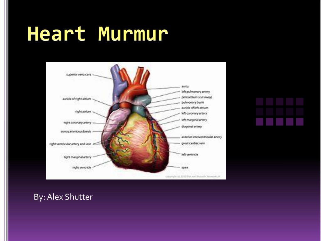 PPT - Heart Murmur PowerPoint Presentation, free download - ID:2331076