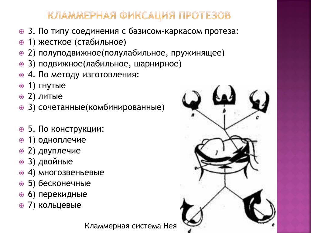 Виды элементов фиксации. Методы фиксации кламмеров. Методы соединения кламмеров с базисом протеза.. Типы кламмеров системы нея. Кламмера по методу изготовления.