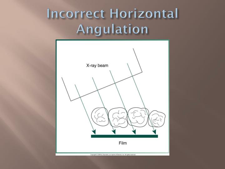 ppt the bisecting technique powerpoint presentation id paralleling technique