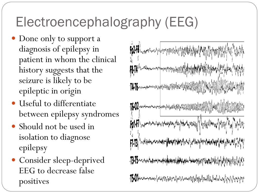 PPT - Epilepsy PowerPoint Presentation, free download - ID:2341272