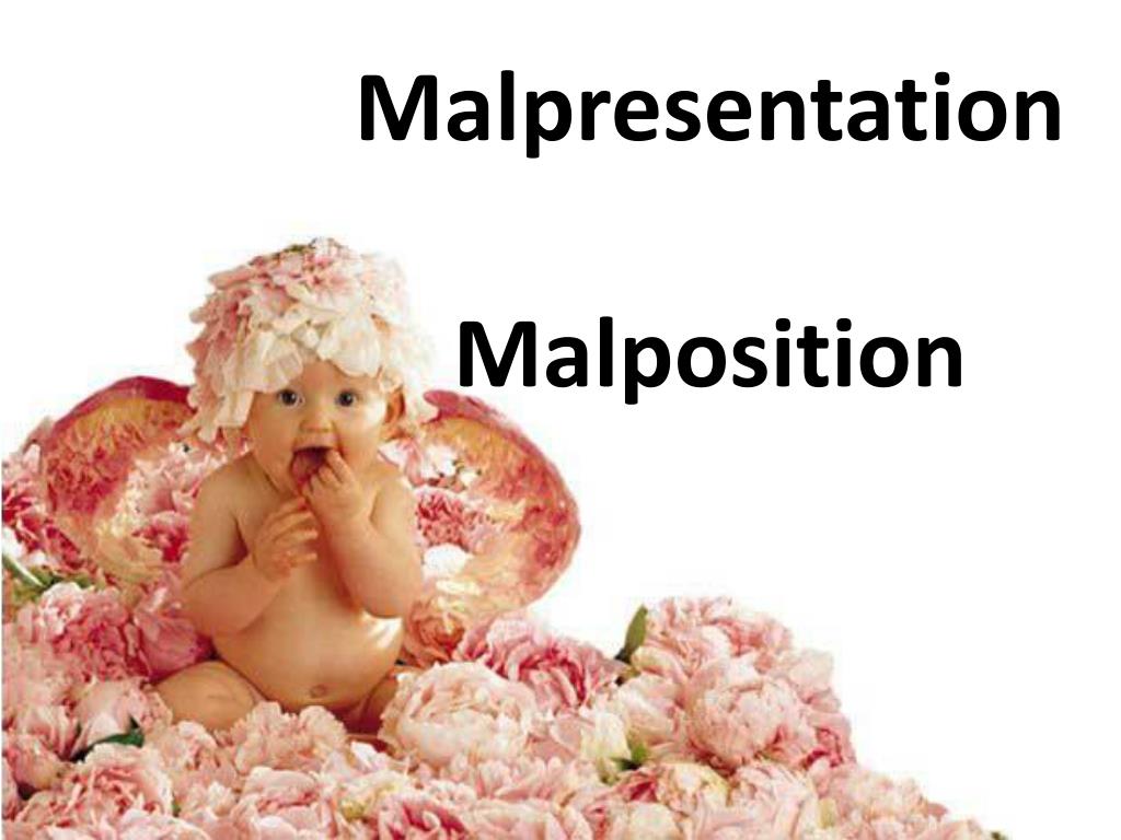define malpresentation