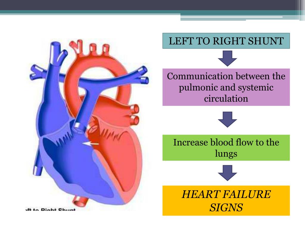 PPT CONGENITAL HEART DISEASES PowerPoint Presentation