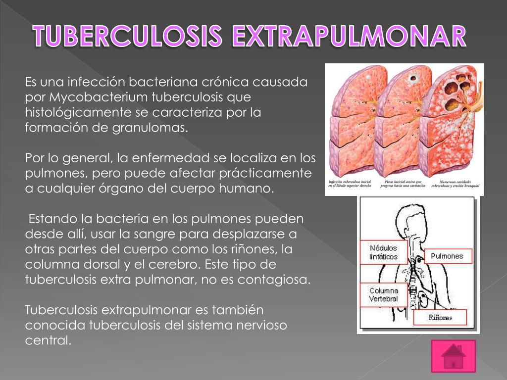 Туберкулез перевод. Tuberculosis перевод с латинского. Tuberculosis латынь строение.