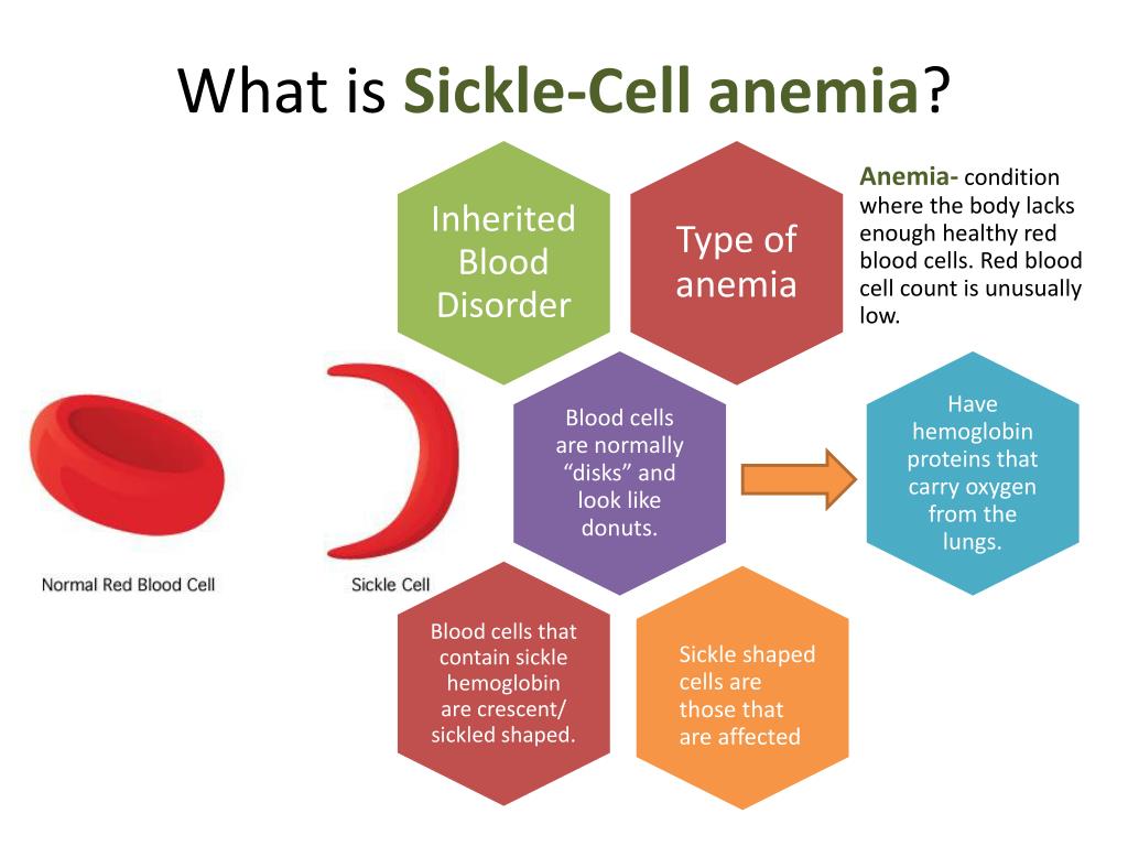 Ppt Sickle Cell Anemia Powerpoint Presentation Free Download Id