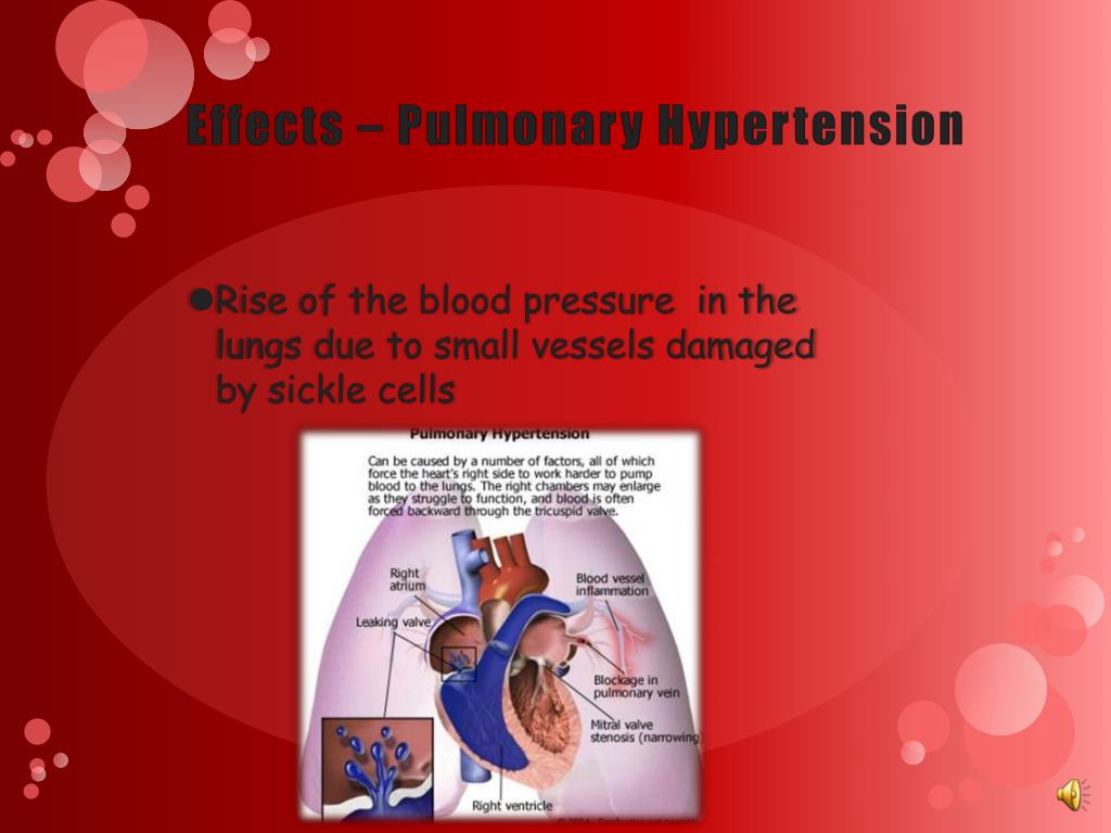 can diltiazem cause blood pressure to rise