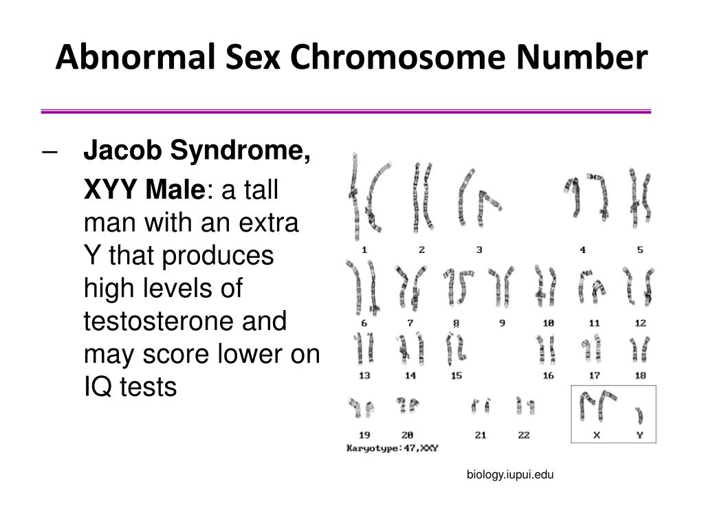 Ppt Chromosomes And Human Inheritance Patterns Of Inheritance
