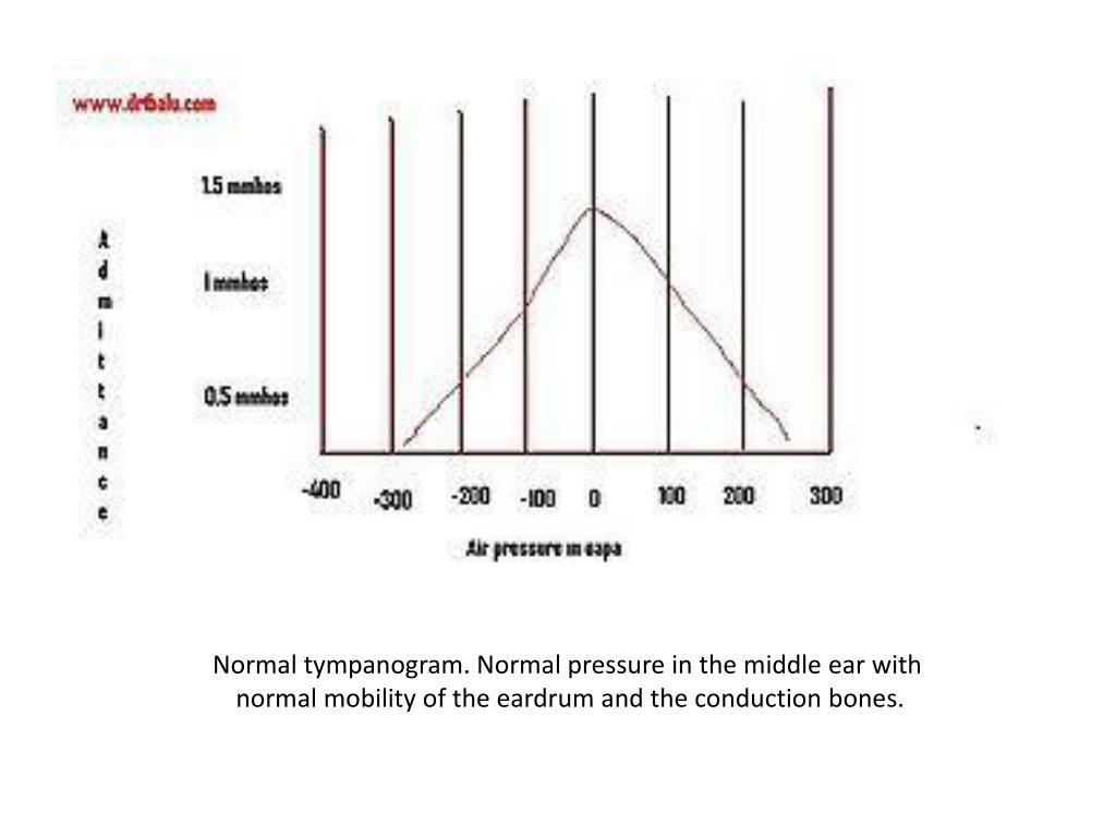 PPT Hearing Screening in Preschool Children (35 years) PowerPoint
