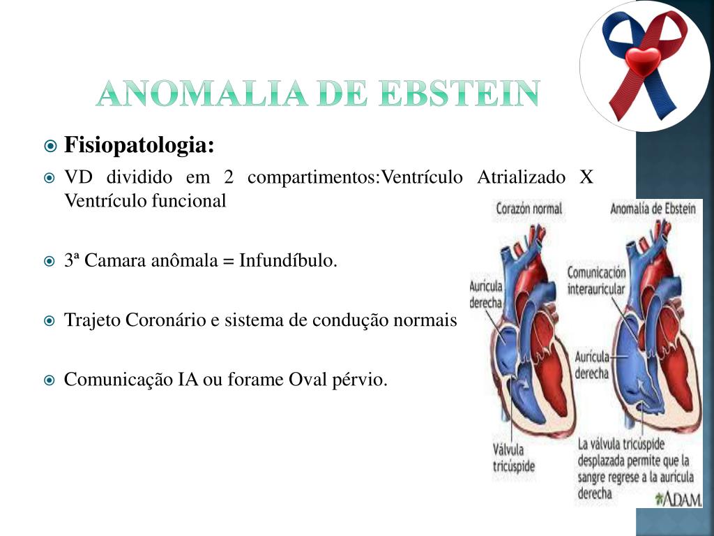 PPT - Cardiopatias Congênitas Cianogênicas PowerPoint Presentation ...