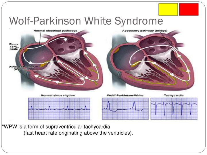 PPT - Cardiovascular--- EKG’s / Cardiac Monitoring PowerPoint ...