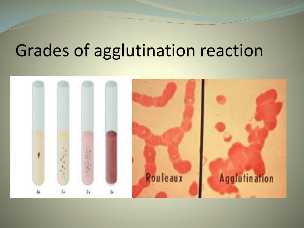 PPT Basic Principles Of Immunology And Ag Ab Reactions PowerPoint Presentation ID